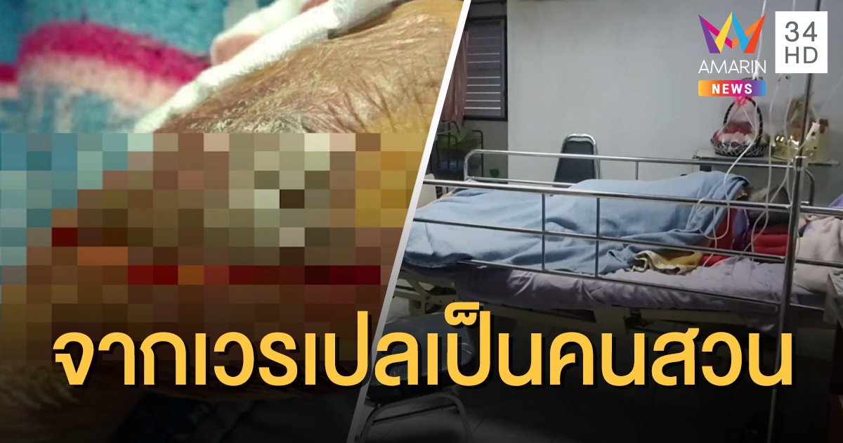 ผอ.รพ.สารภี สั่งย้ายหนุ่มเวรเปลไปเป็นคนสวน หลังกระชากแขนคนไข้ชราจนหนังฉีก