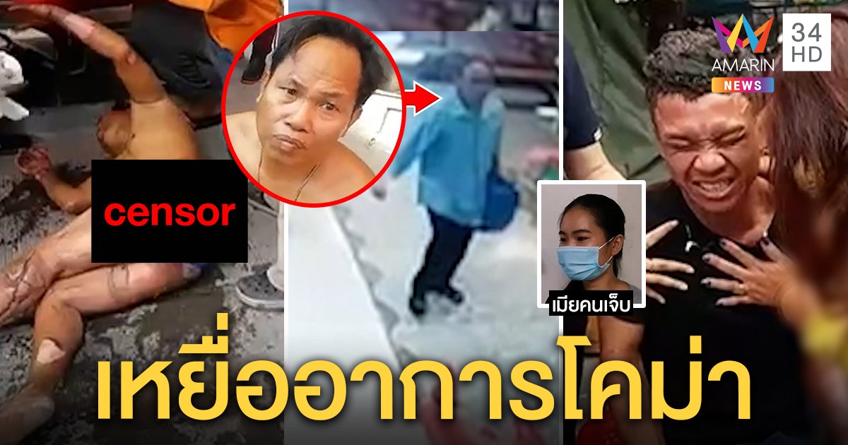 เหยื่อ “ไอ้หลอด” เผาตัวประชดเมียโคม่าแผลสาหัสเข้า ICU ญาติซึ้งนายจ้างช่วยรักษา (คลิป)