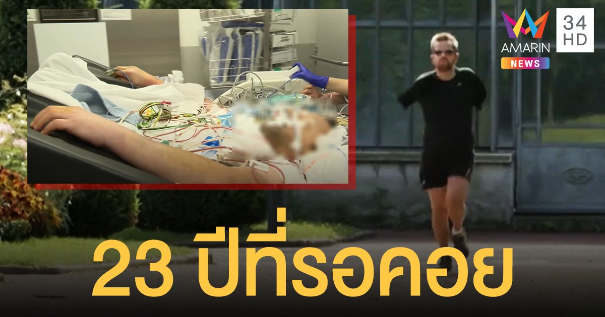 คนแรกของโลก! หนุ่มไอซ์แลนด์ปลูกถ่ายแขน-ไหล่ใหม่สำเร็จ หลังถูกตัดมา 23 ปี