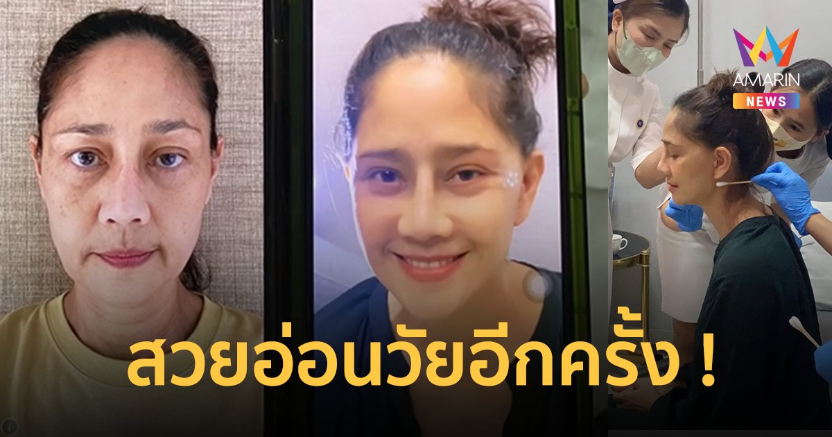 "นก สินจัย" อวดหน้าใหม่ เด็กลงมาก หลังขึ้นเขียงทำศัลยกรรมในวัย 58 ปี