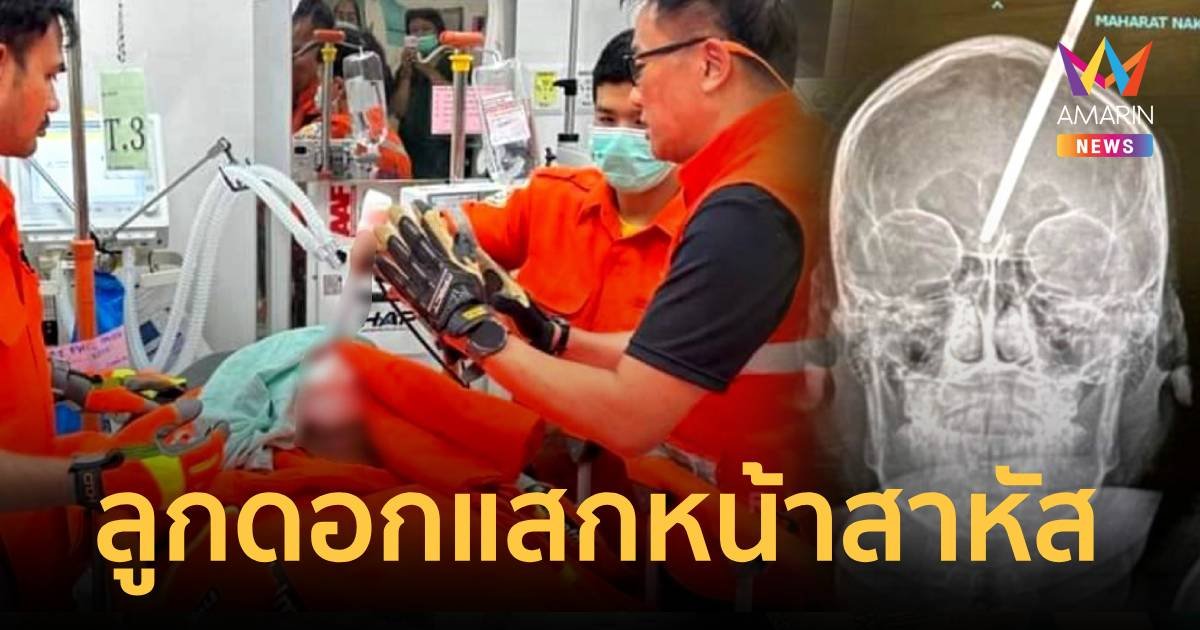 เด็กวัย 14 ปี ไปหาปลาพลาดถูกลูกดอกยิงปักเข้ากลางแสกหน้าสาหัส