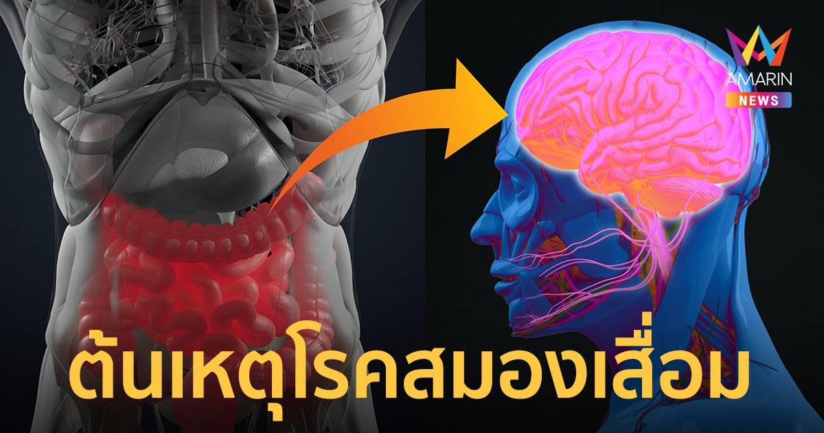 ทีมวิจัยค้นพบ ต้นเหตุ "โรคสมองเสื่อม" อาจเกิดจากจุลินทรีย์ในลำไส้