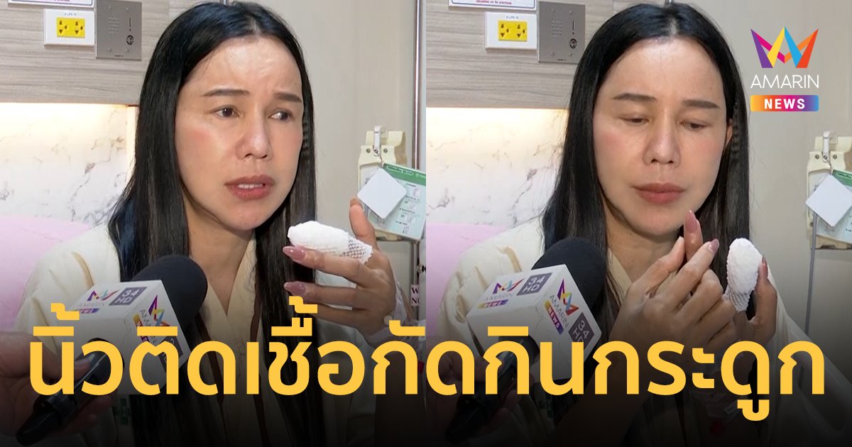 “ส้มเช้ง สามช่า” เผยเสี่ยงโดนตัดนิ้ว ! ตรวจพบนิ้วติดเชื้อกัดกินกระดูก