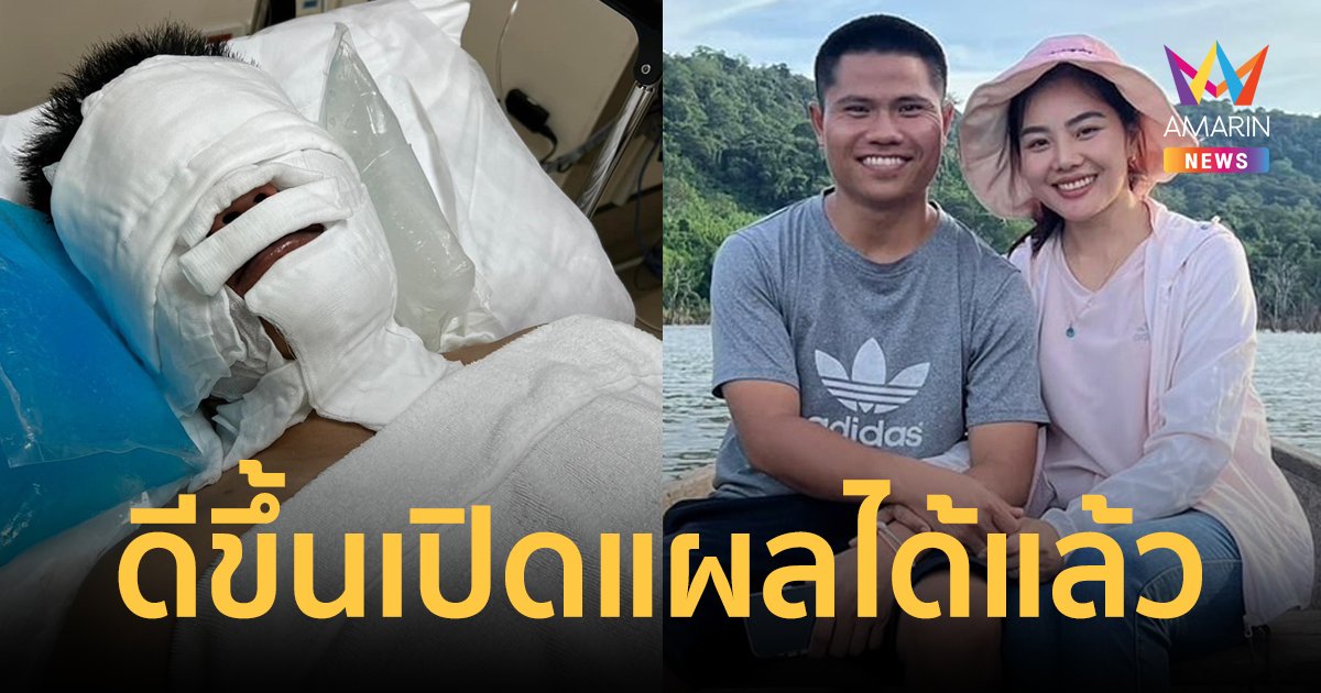 ภรรยาอัปเดตอาการ "อาจารย์จินนี่ ภูไท" ดีขึ้นเปิดแผลบริเวณใบหน้าได้แล้ว