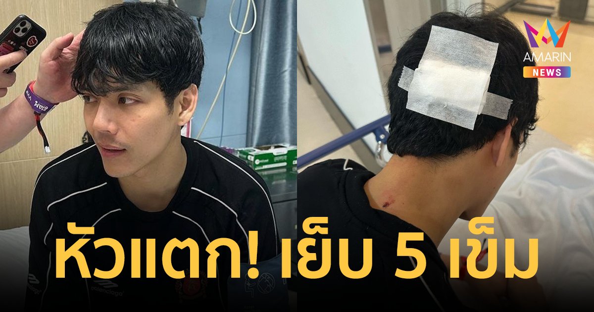 "นิกกี้ ณฉัตร" ได้เลือดรับสงกรานต์วันแรก หัวแตก! ต้องเย็บถึง 5 เข็ม
