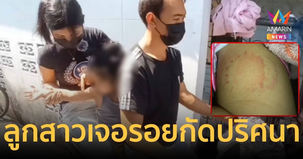 ต้องหมั่นเขี้ยวแค่ไหน! แม่พาลูกสาว 2 ขวบไปเล่นสงกรานต์ถูกกัดปริศนา   