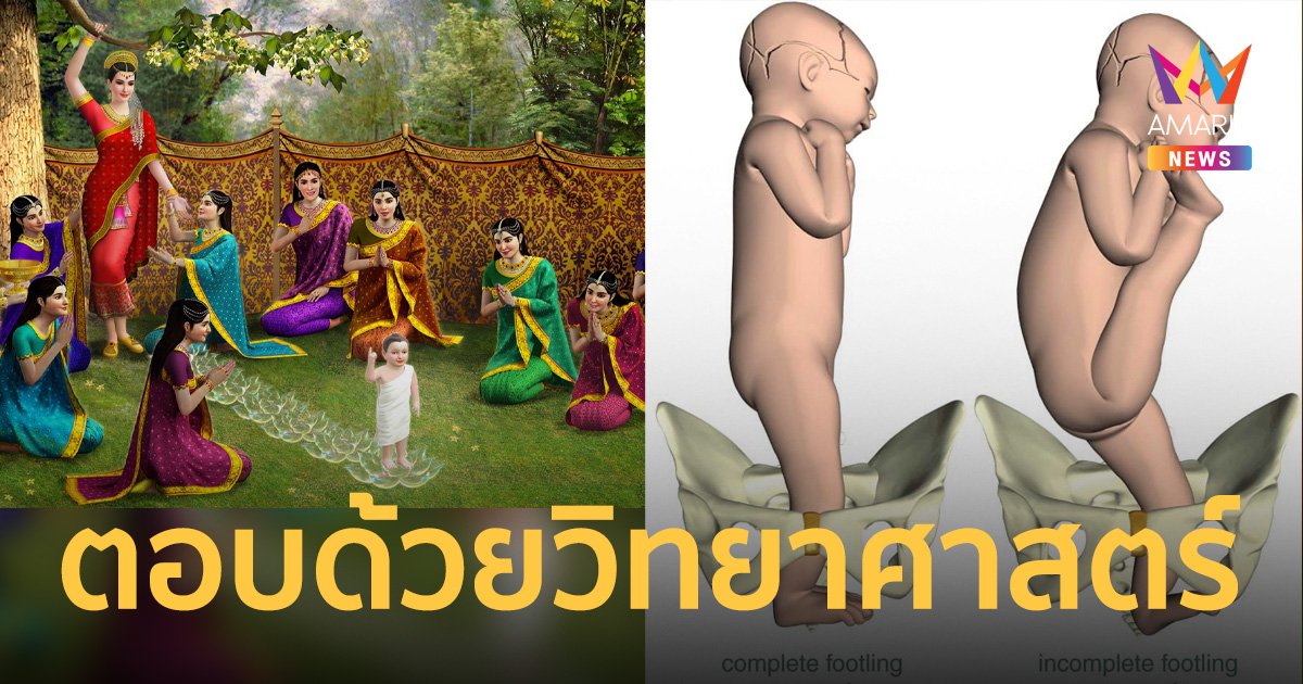 หมอไขข้อสงสัย เจ้าชายสิทธัตถะ เกิดแล้วเดินได้ 7 ก้าว จริงหรือไม่ ด้วยวิทยาศาสตร์
