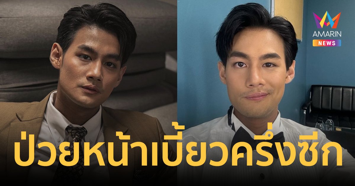 พระเอกหนุ่ม "ธัช กิตติธัช" ป่วยโรคหน้าเบี้ยวครึ่งซีก ตา-ปาก ฝั่งซ้ายขยับไม่ได้