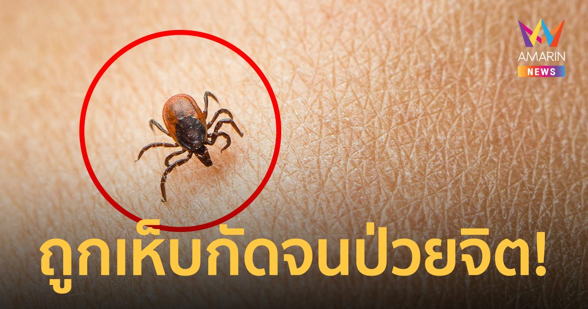 ช็อก! บาทหลวงเฉือนองคชาตตัวเองขาด คาดถูกเห็บกัดป่วยไข้สมองจนเป็นโรคจิต