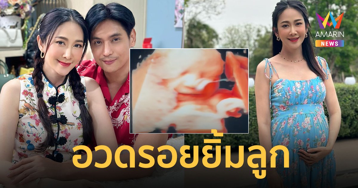 “ยุ้ย จีรนันท์” นับถอยหลังคลอด ! อวดคลิปอัลตร้าซาวด์ ลูกยิ้มน่าเอ็นดู