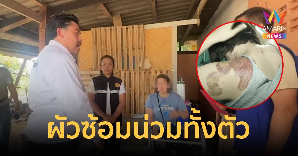 หญิงขาพิการ ถูกผัวซ้อมน่วมทั้งตัว ร้อง "กันจอมพลัง" ช่วย