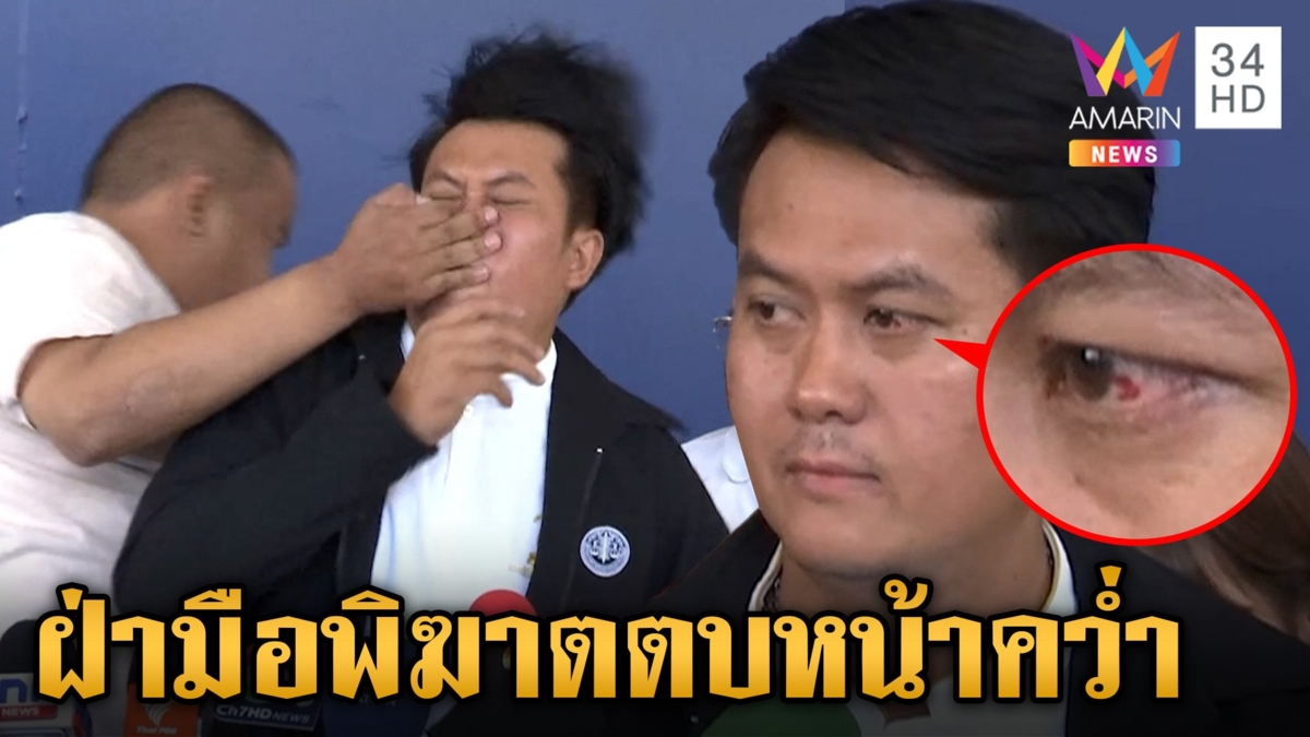 เปิดนาทีหนุ่มบุกตบปาก "ทนายธรรมราช" ยันไม่ได้มีความแค้น