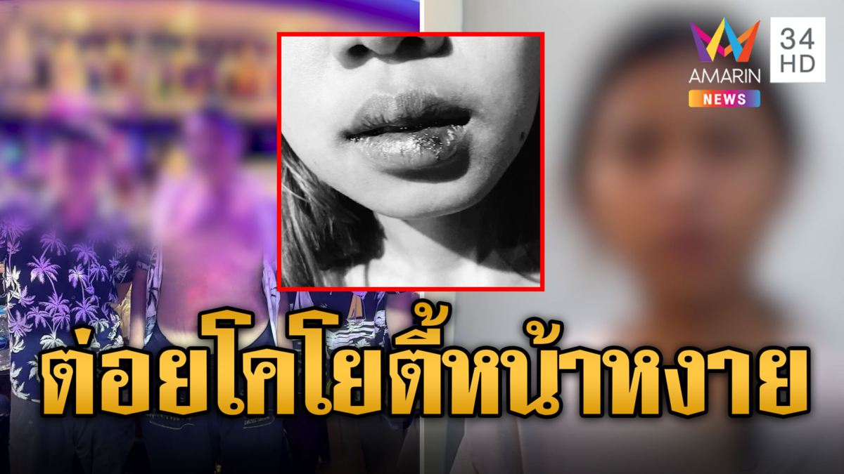 บาร์เทนเดอร์ สาวหมัดใส่โคโยตี้-แฟนหนุ่มหน้ายับ