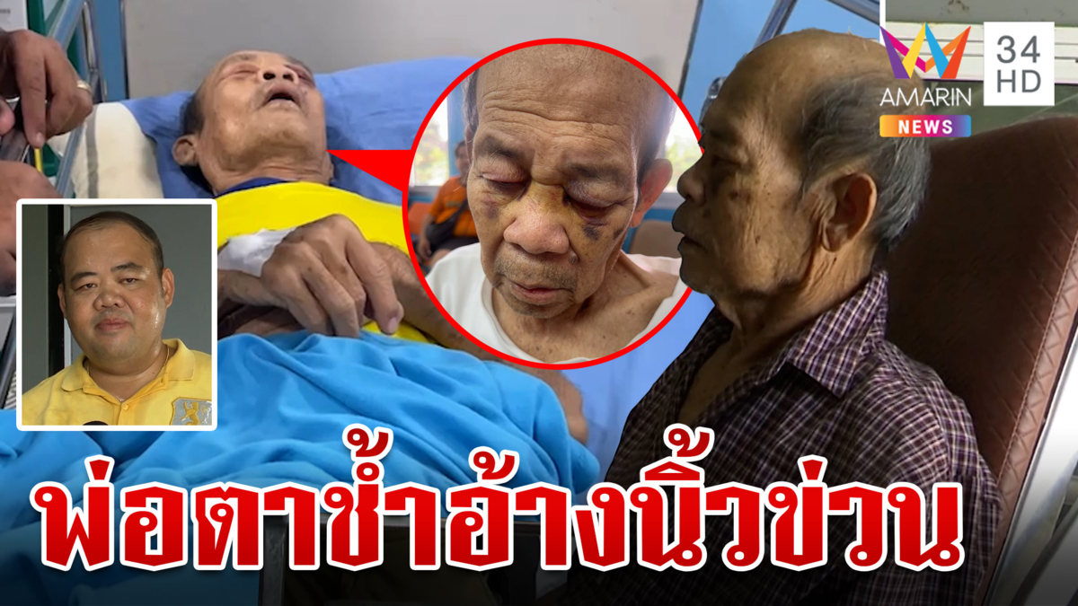 ลูกคาใจศูนย์ดูแลคนชราทำพ่อตาช้ำ ขอดูวงจรปิดบอกกล้องไม่บันทึก