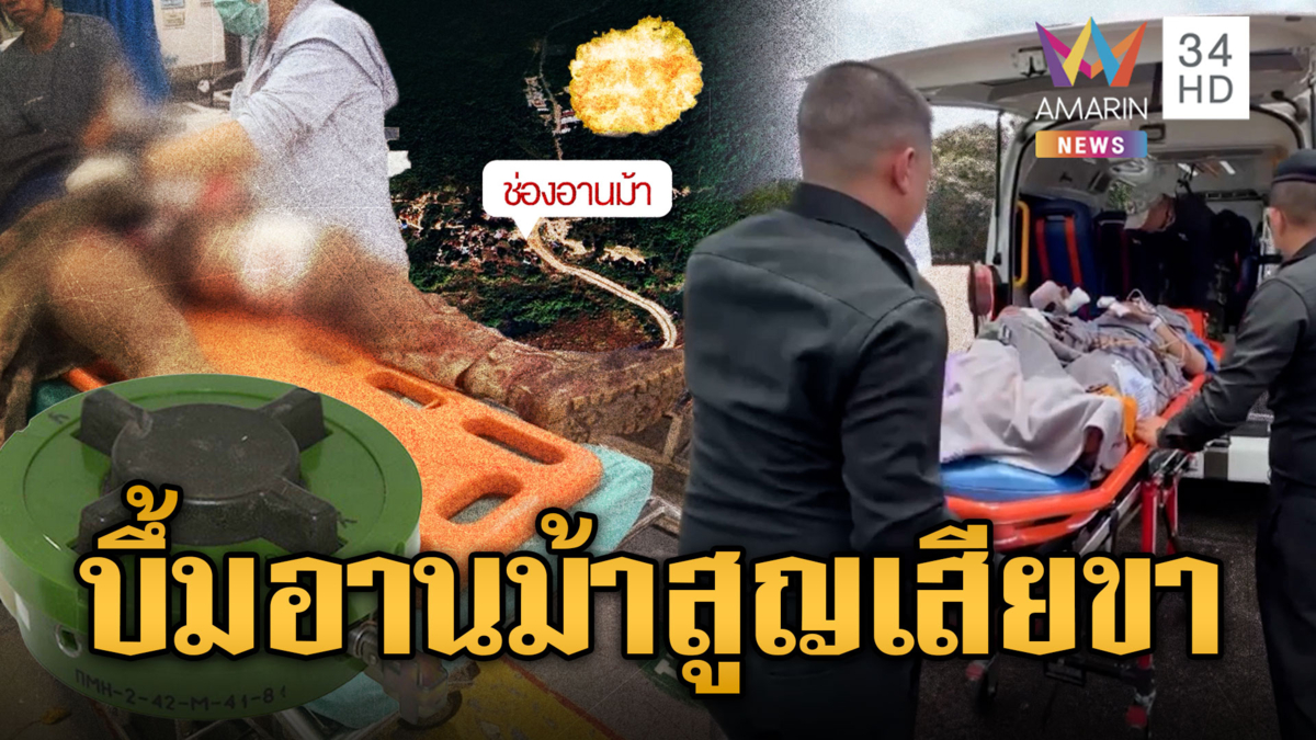 “จ่าโจ้” เหยียบทุ่นระเบิดเขมร สูญเสียขาที่ 15