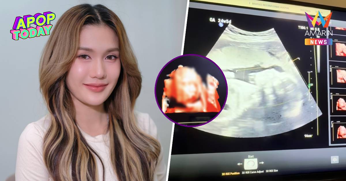 "ฟารีดา" เปิดภาพอัลตราซาวด์ "น้องเวร่า" เห็นหน้าชัด แก้มอิ่มฉ่ำ