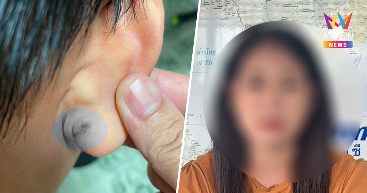 แม่สุดทน! ครูดึงหูนักเรียน ป.2 เลือดออก เด็กผวาไม่กล้าเรียน
