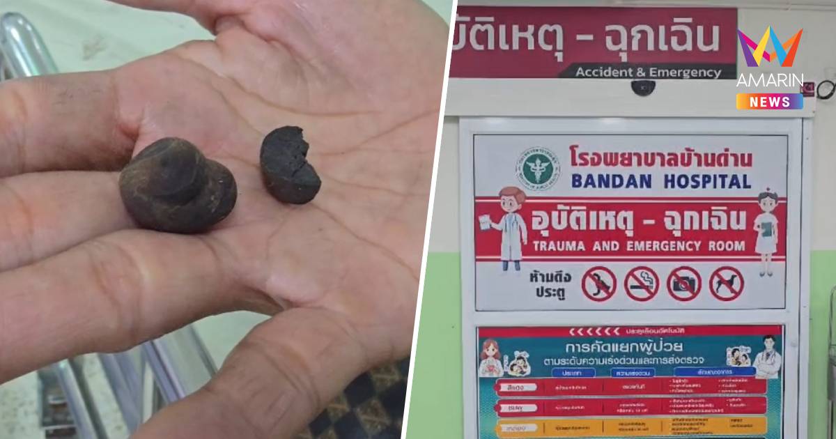 เตือนสายเห็ด! หามสามีภรรยาส่งโรงพยาบาล มีอาการอาเจียน หลังกินเห็ดในป่า