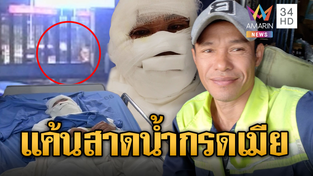 ผัวแค้นโดนบอกเลิก สาดน้ำกรดใส่เมีย อ้างแค่น้ำยาแอร์