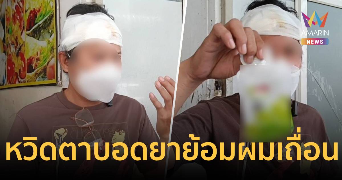 อุทาหรณ์! สั่งยาย้อมผมจากออนไลน์ ทำหัวเน่า น้ำเหลืองไหลเยิ้ม