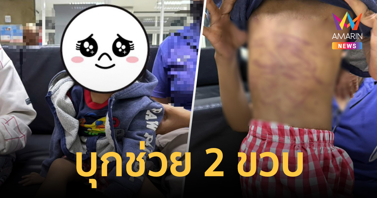 เทศบาลเมืองกะทู้ บุกช่วย 2 ขวบถูกพ่อเลี้ยงทำร้ายยับ ดำเนินคดีถึงที่สุด