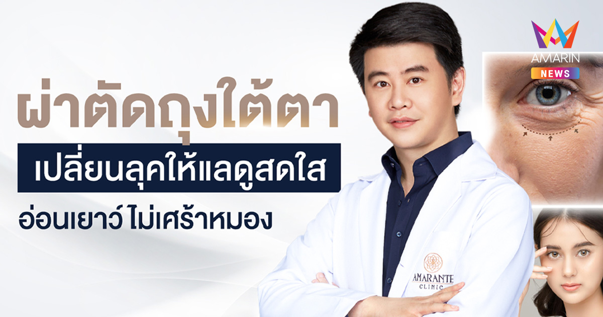 ผ่าตัดถุงใต้ตา เปลี่ยนลุคให้ดูสดใสห่างไกลหน้าโทรมเกินวัย