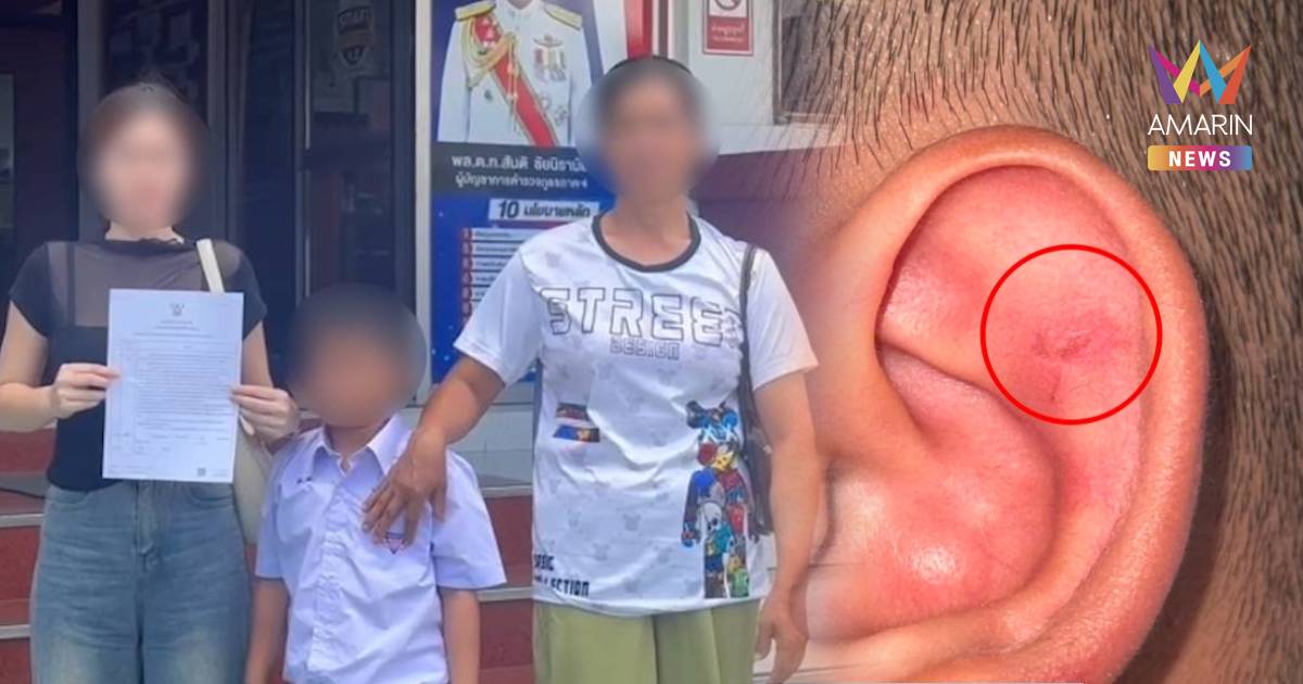 เกินกว่าเหตุไหม? ครูทำโทษหยิกหู ป.1เป็นรอยเล็บทั้ง 2 ข้าง