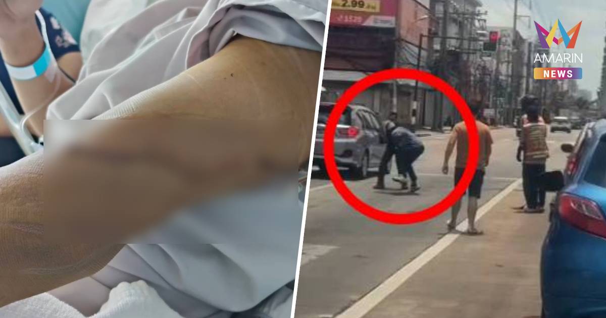 "แค่บีบแตรเตือน" เก๋งฉุนจัด ขับจี้ท้าย-ดักเคลียร์ ก่อนชักมีดแทงสาหัส