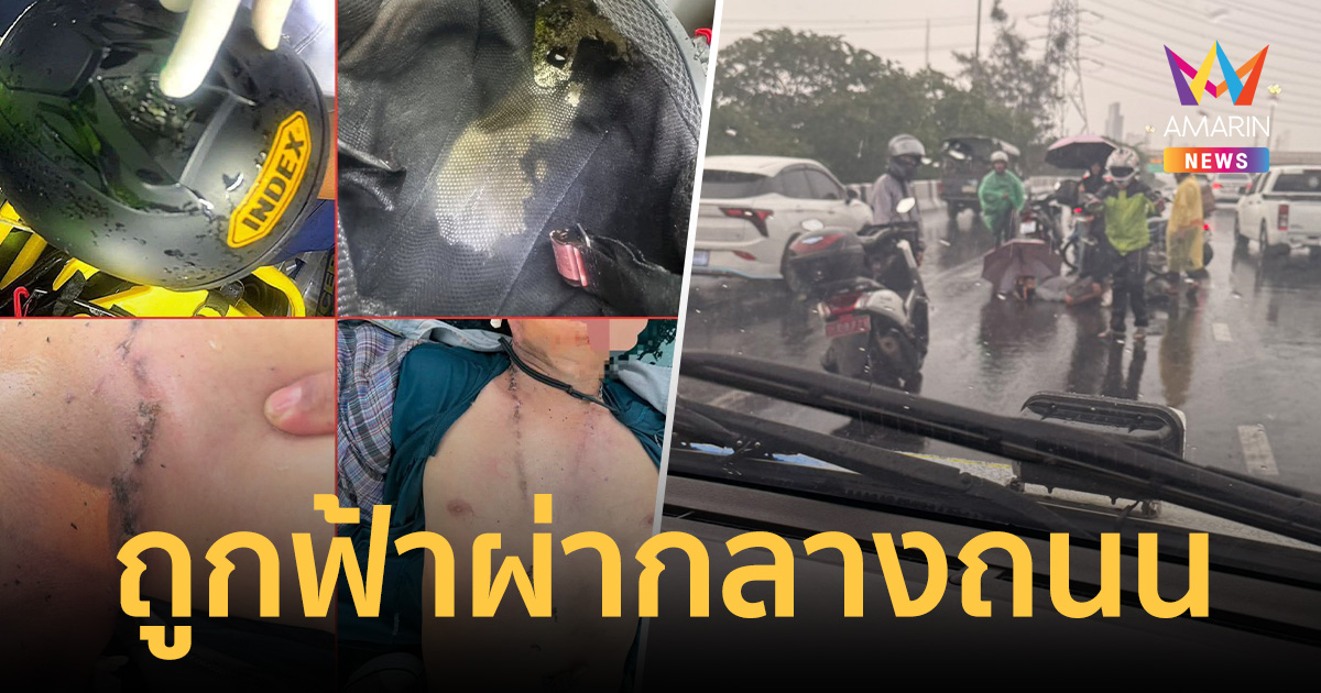 อุทาหรณ์หน้าฝน! หนุ่มบิดมอเตอร์ไซค์ฝ่าพายุ ถูกฟ้าผ่ากลางลำตัวเจ็บสาหัส