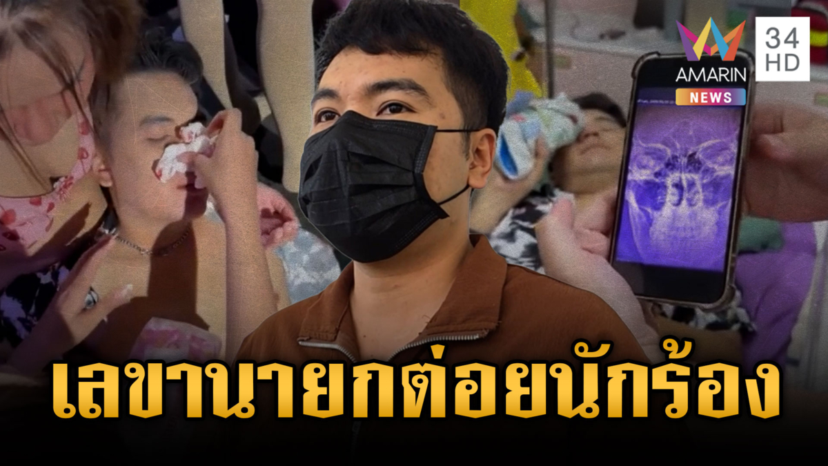 อดีตเลขานายกฯ เมาหึงเมีย ต่อยนักร้องหนุ่มดั้งหัก