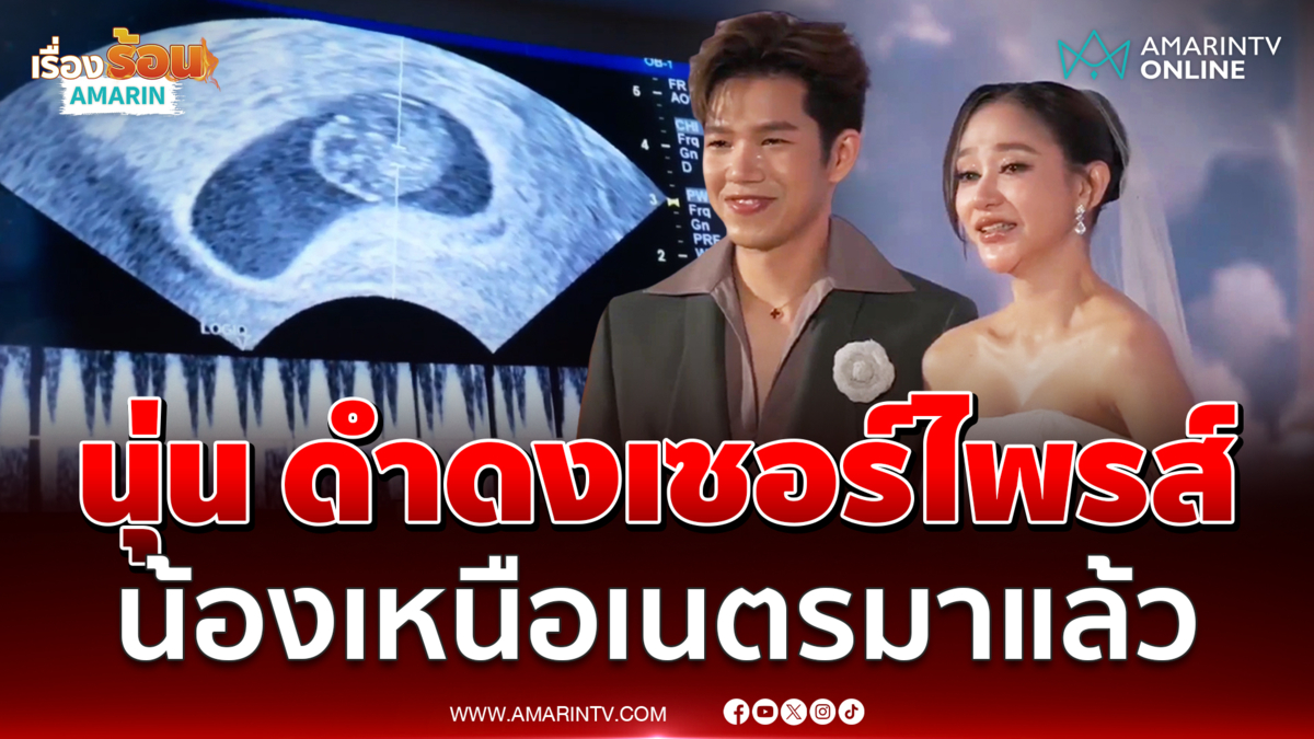 นุ่น ดำดงเซอร์ไพรส์กลางงานแต่ง น้องเหนือเนตรมาแล้ว