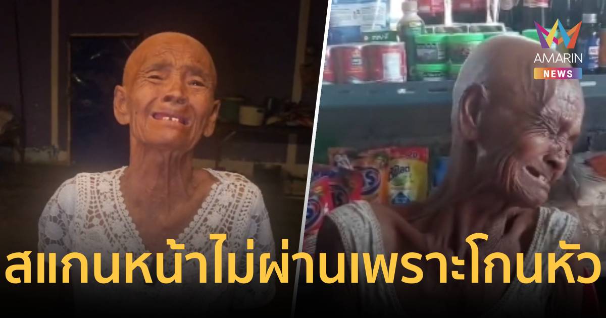ยายวัย 76 ป่วยมะเร็งโกนหัว สแกนหน้าบัตรคนจนไม่ผ่าน 20 ครั้งปล่อยโฮ