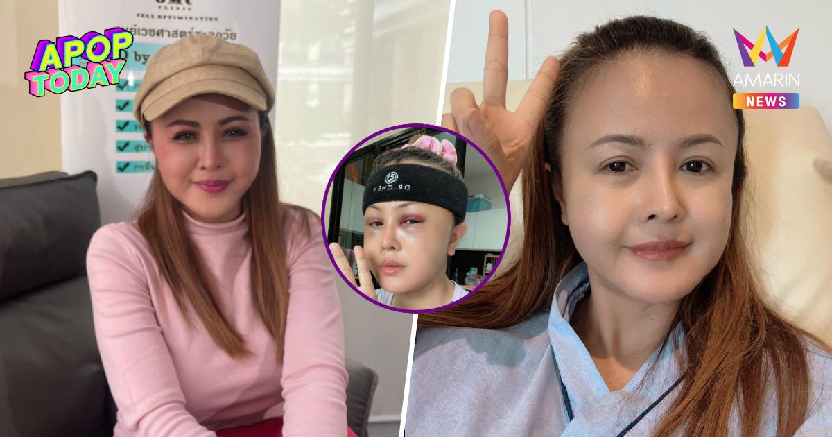 “ลำยอง หนองหินห่าว” แจงหน้าใหม่ทำฟรี! แฉอดีตพิษหมอกระเป๋าทำหน้าพัง