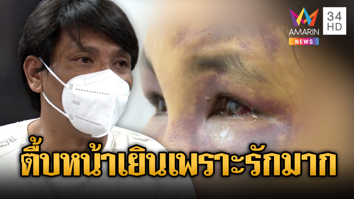 เมียร้องผัวขี้ยาซ้อมมาราธอนตาปูด-ผัวอ้างทำเพราะรัก