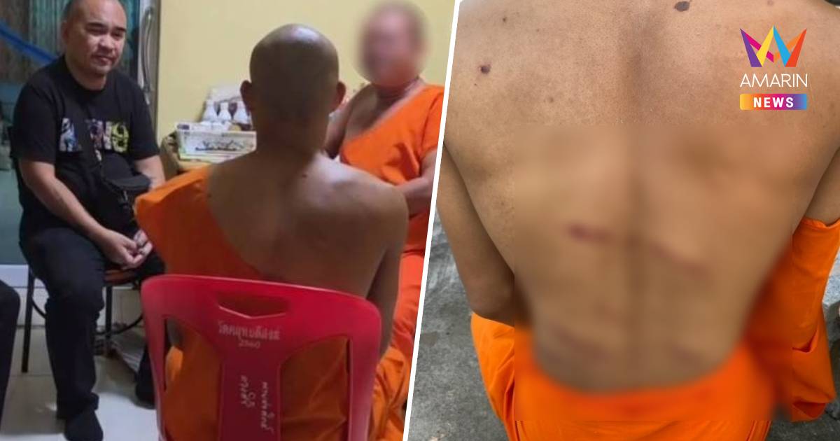 เณรยันไม่ได้ถูกพระตี! แต่แผลเต็มหลัง