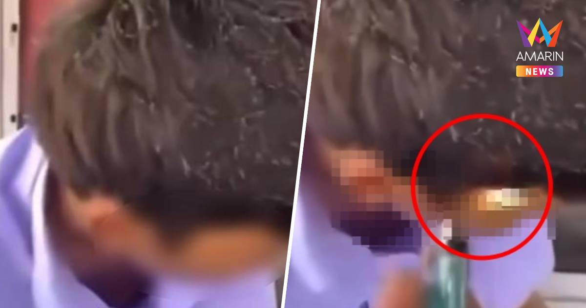 แม่ร้อง ลูกชายถูกเพื่อนจุดไฟแช็ก ‘เผาหัว’ คาโรงเรียนชายชื่อดังโคราช