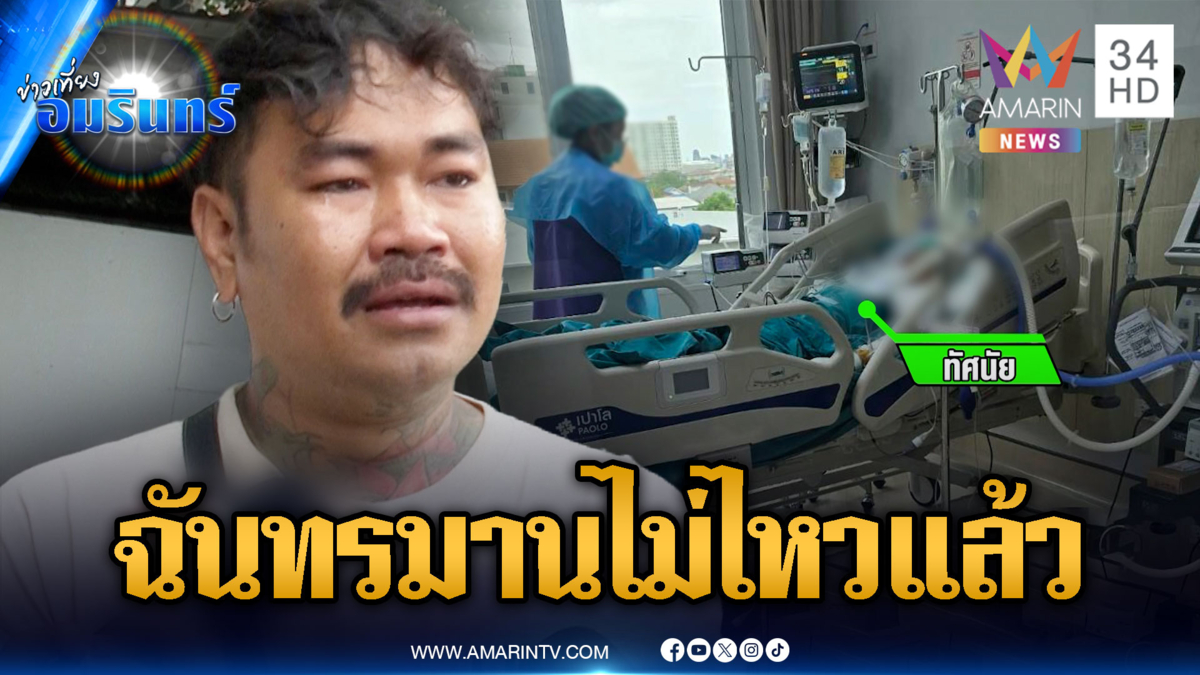 ผัวช้ำใจเมียอาการวิกฤต! ไฟคลอกทั่วร่างกาย