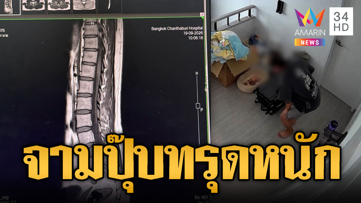 จามแรงๆ แค่ครั้งเดียว หมอนรองกระดูกปริ