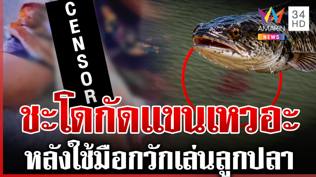 "ชะโด" พันธุ์ดุหวงลูก พุ่งกัดแขนเด็ก 13 เหวอะ ต้องรีบนำส่ง รพ.ด่วน