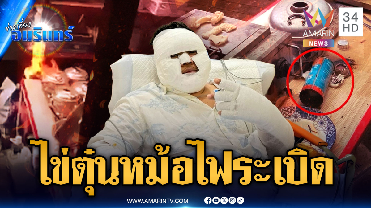 สยองหม้อไฟไข่ตุ๋น แก๊สระเบิดไฟลวกเจ้าของร้าน