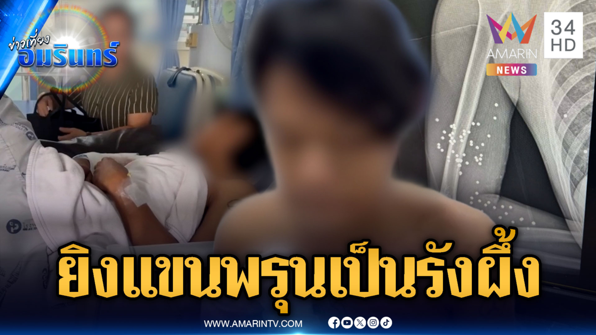 แก๊งวัยรุ่นไล่ยิง 3 เยาวชน แขนพรุนเป็นรังผึ้ง
