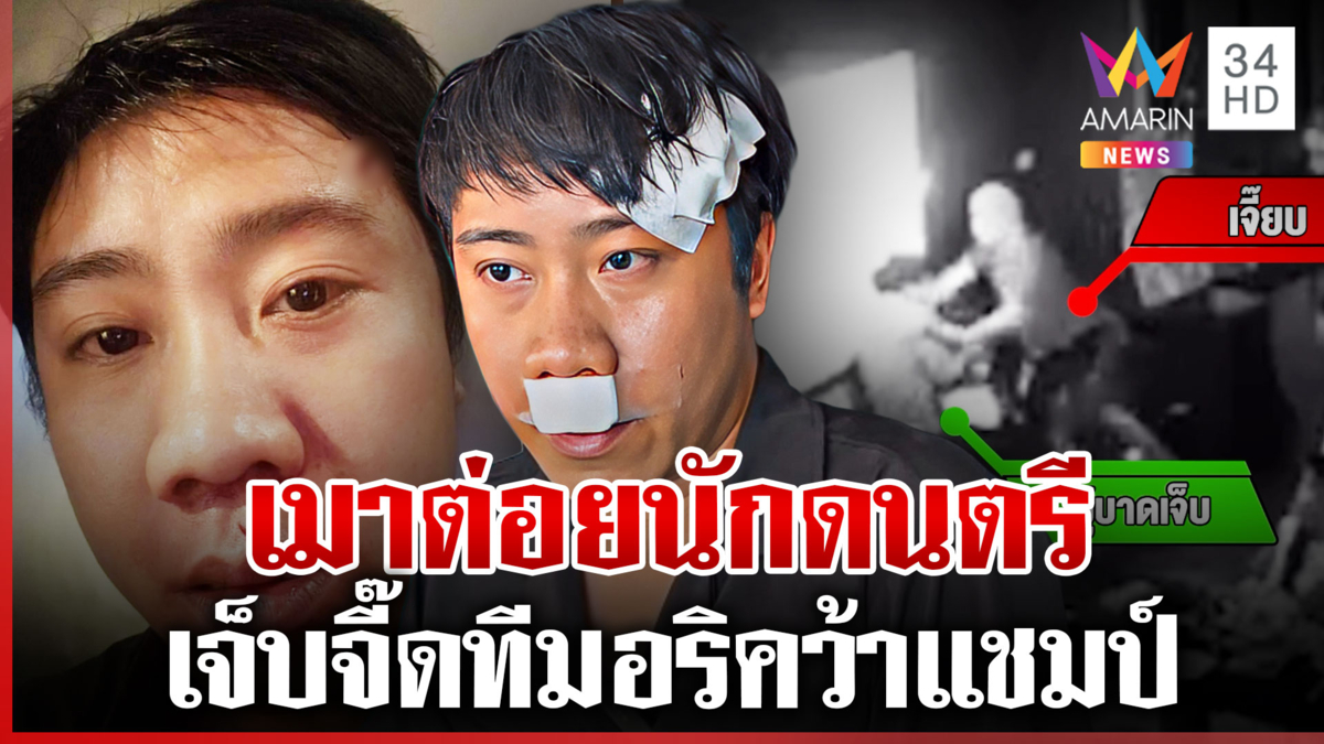 ลูกค้าเมารัวหมัดใส่นักดนตรีหน้ายับ หลังได้ยินคำอวยทีมรักคว้าแชมป์