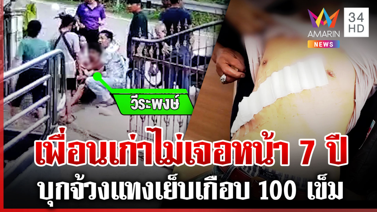 เพื่อนเก่าไม่เจอนาน 7 ปี คลั่งแทงแผลยาวอกถึงเอว เย็บเฉียด 100 เข็ม