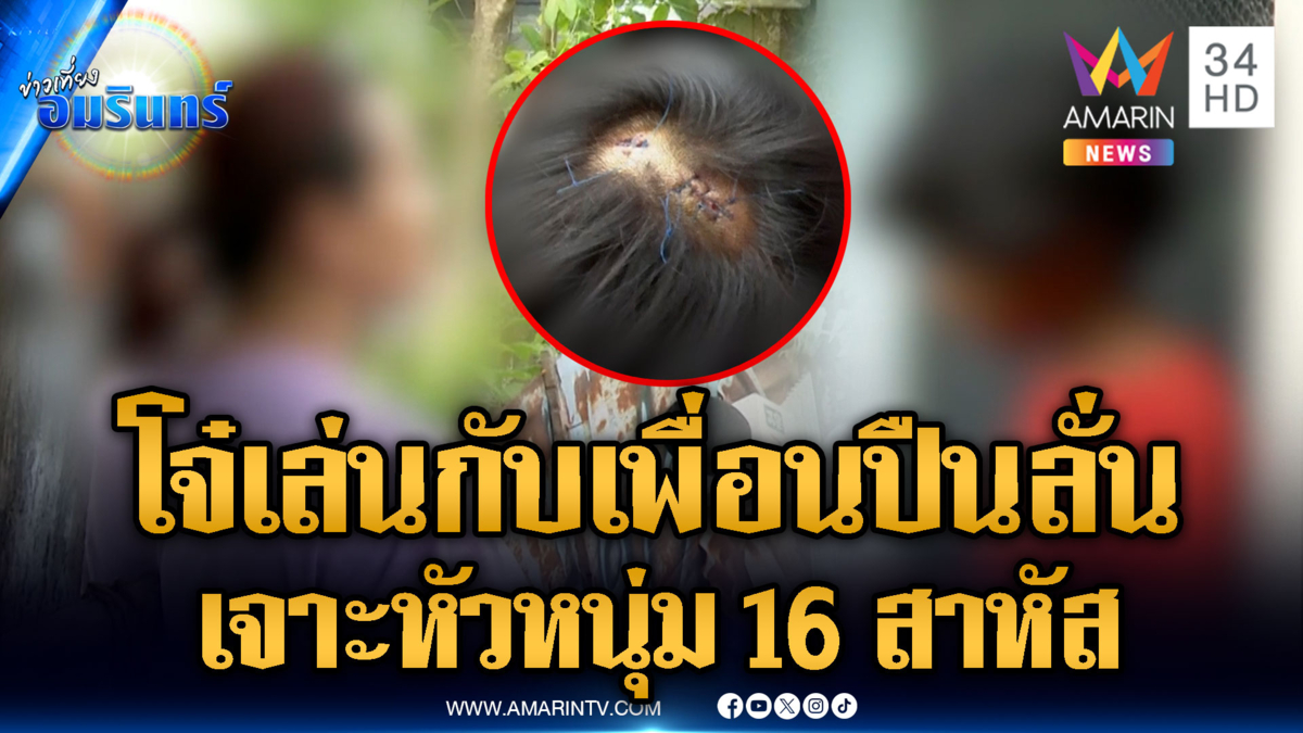 เพื่อนทำปืนลั่นเข้าหัวหนุ่ม 16 เจ็บสาหัส