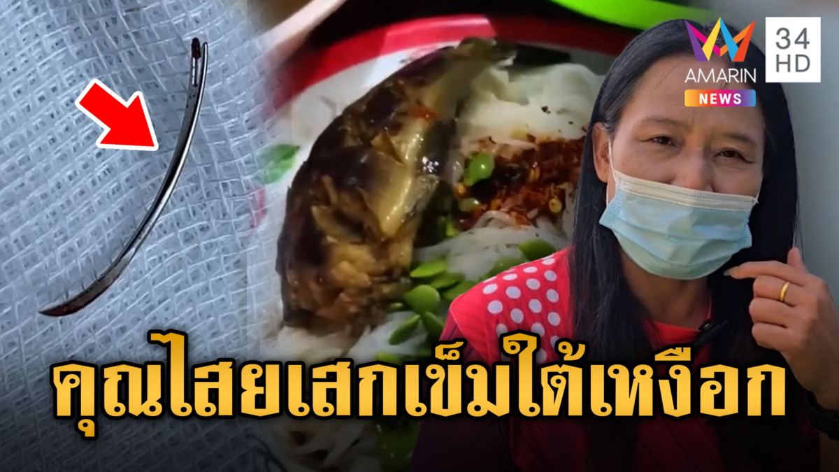 หวั่นคุณไสย! สาวผวาเข็มปริศนาใต้เหงือกกว่า 10 ปี