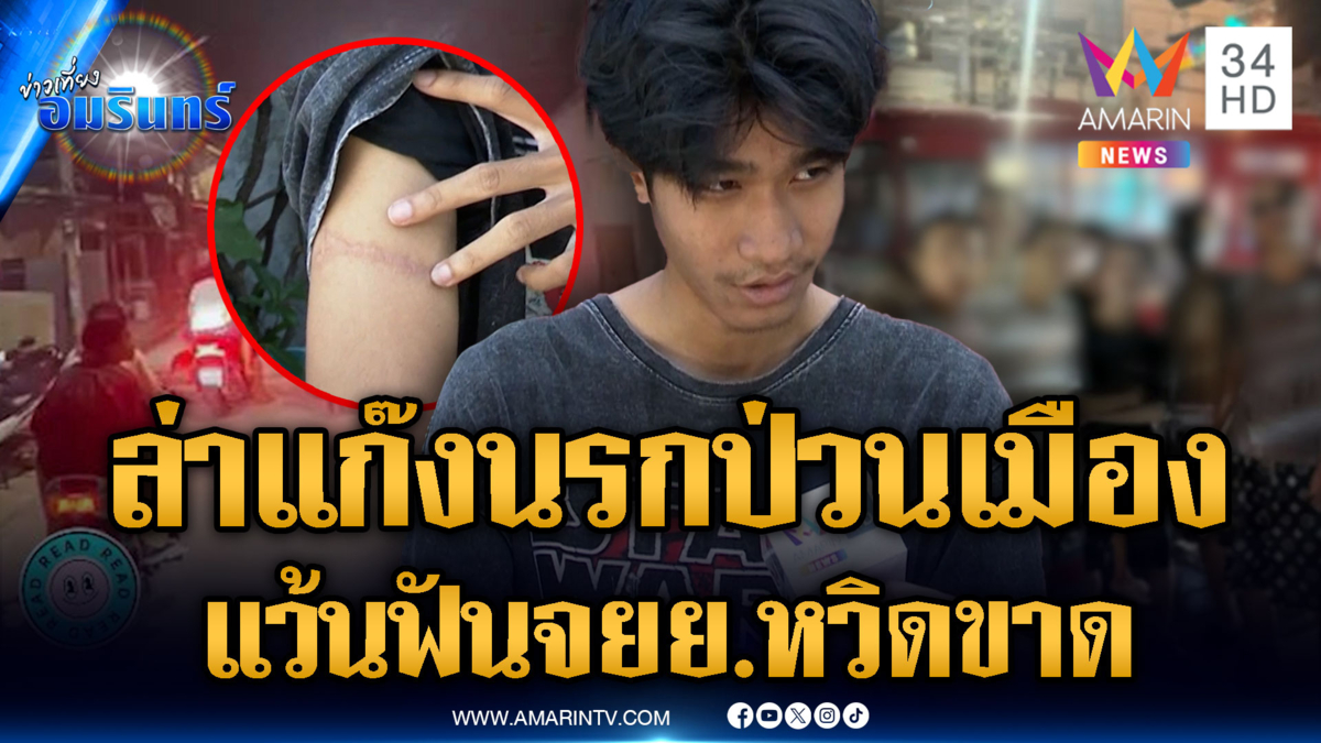ล่า จยย.ประกบฟันแขนหวิดขาด