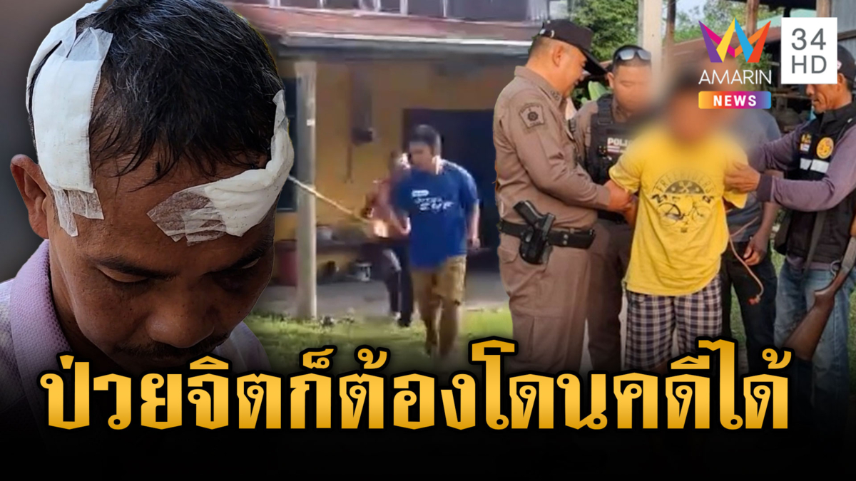 เจ เบนซินคลั่งยา ฟันเพื่อนบ้านเย็บ 80 เข็ม