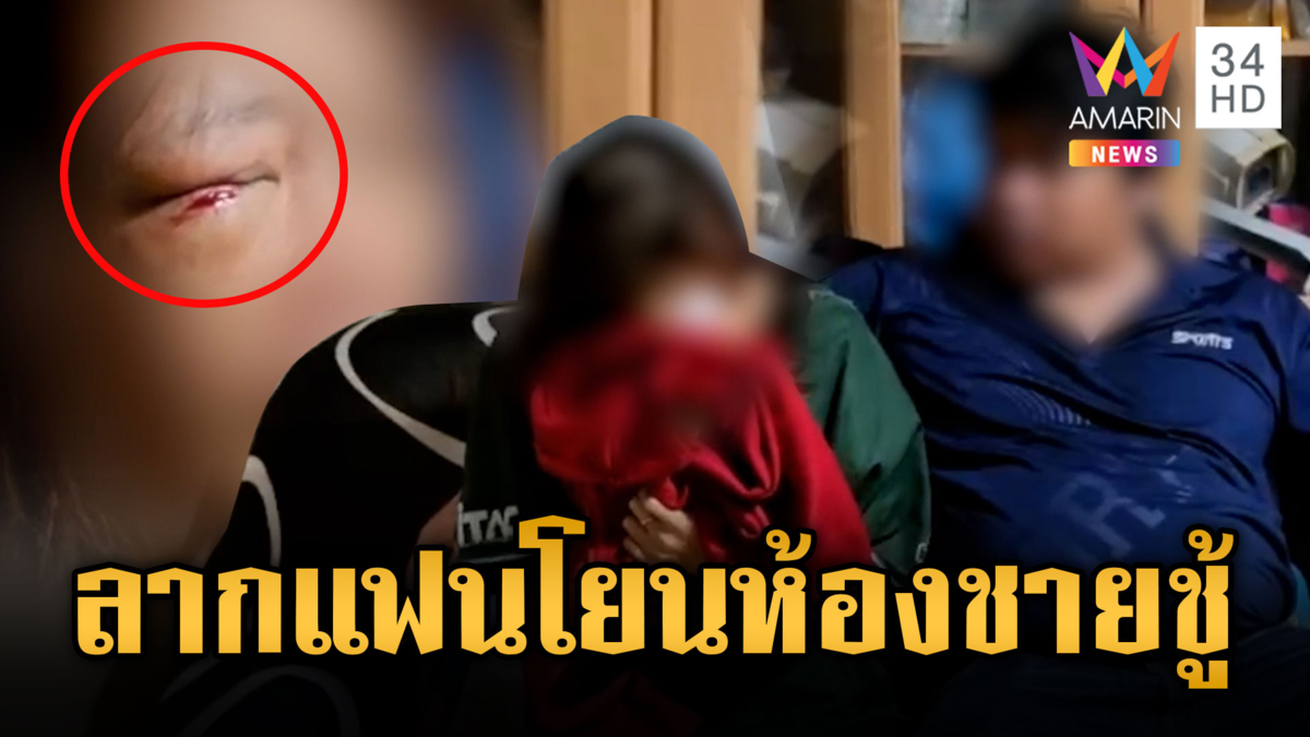 ผัวฉุนเมียต่อยตาแตก เห็นแชตกับผู้ชาย ไปนอนด้วยกัน