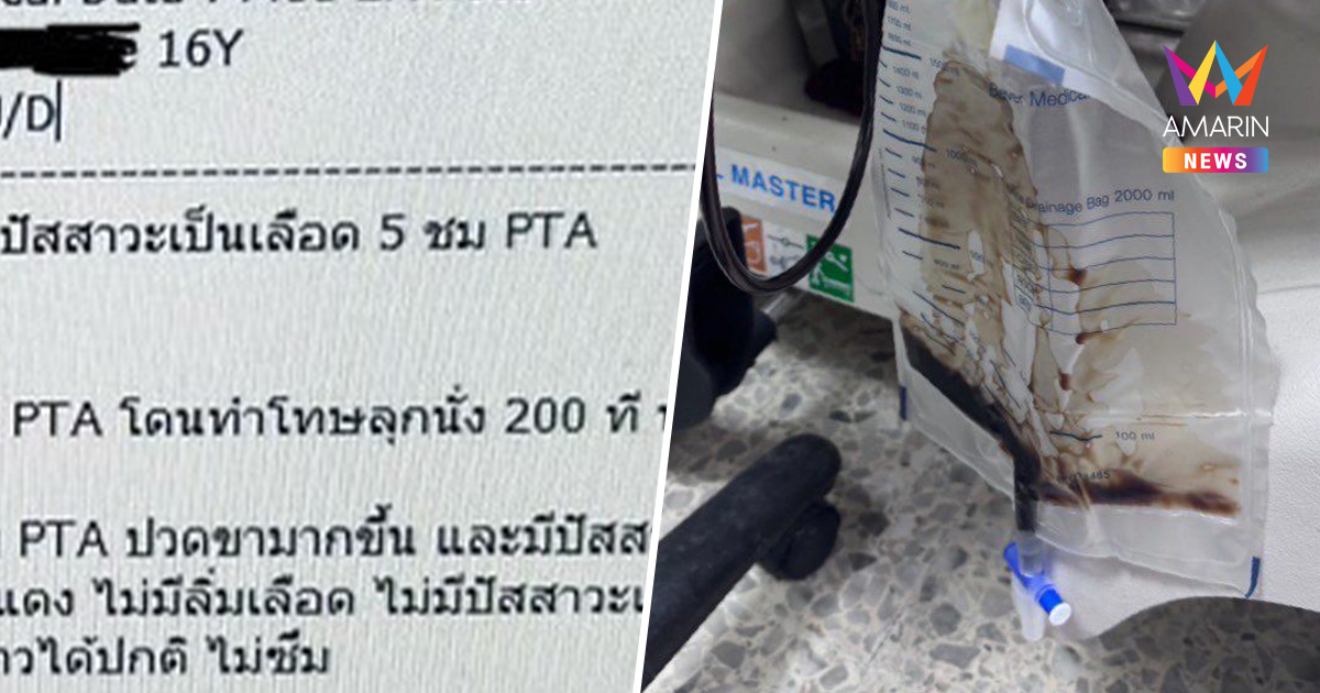 อุทาหรณ์! ครูลงโทษนักเรียน ลุกนั่ง 200 ครั้งรวดเดียว สุดท้ายไตวาย