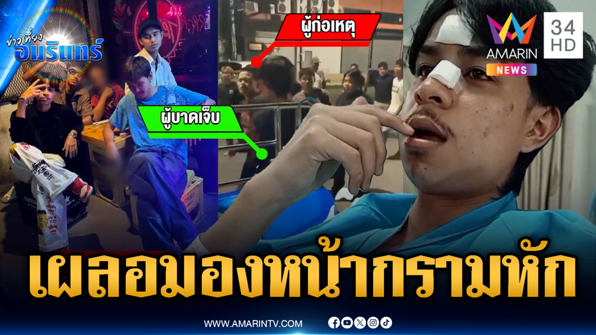 เผลอมองหน้าในผับ 3 พี่น้องโดนรุมตื้บปากฉีก-กรามหัก